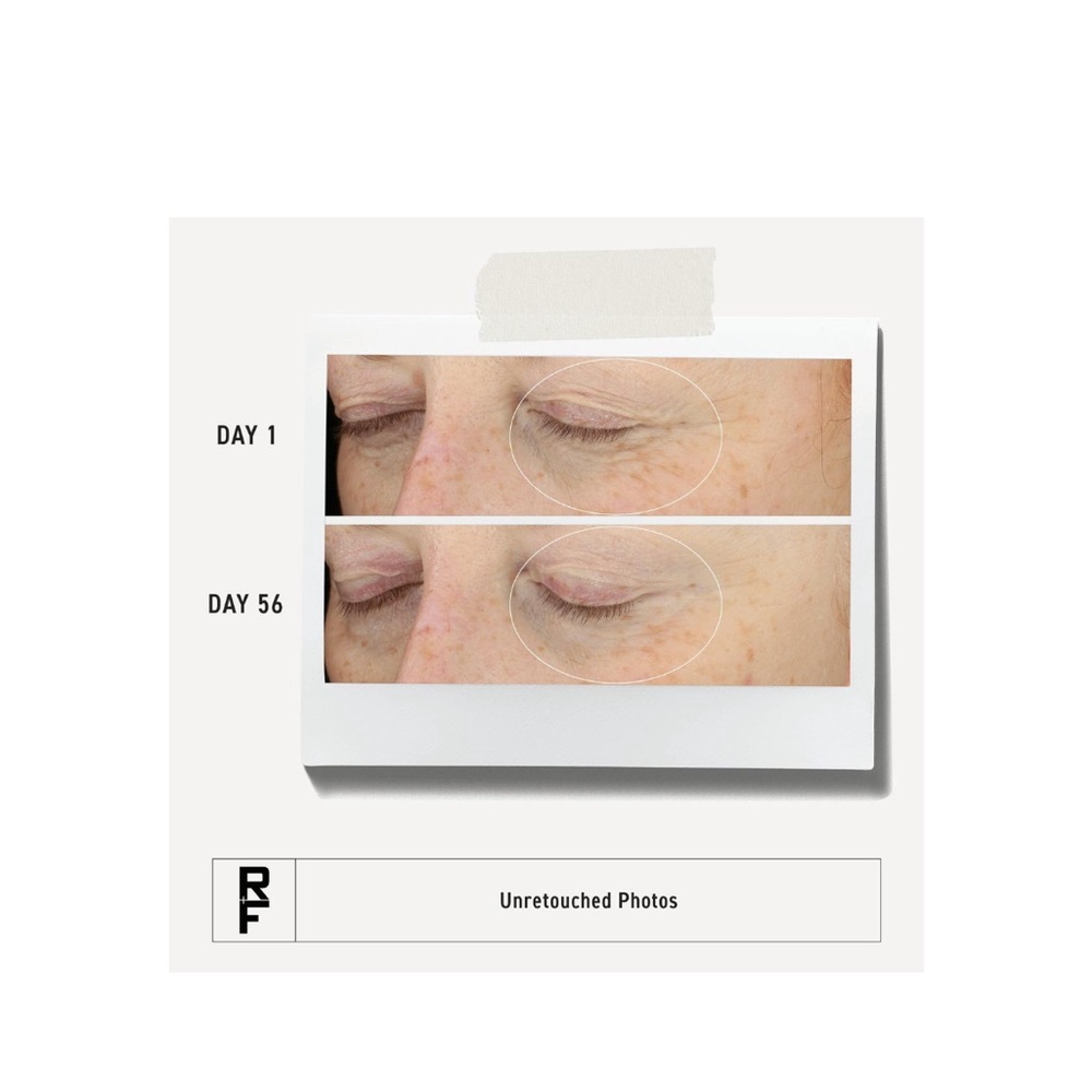 Rodan + Fields Redefine Multi-Function Eye Cream - Picture 5 of 5